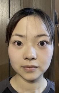 施術後の提供写真 1