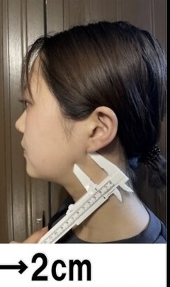 施術後の提供写真 2