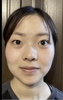 施術前の提供写真 1