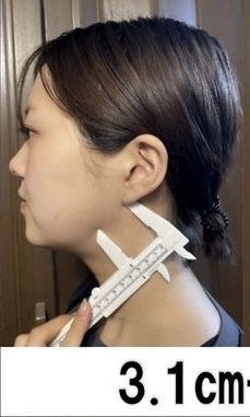 施術前の提供写真 2