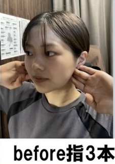 施術前の提供写真 3